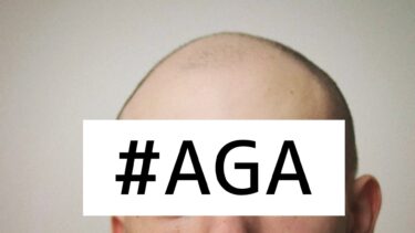 AGA（男性型脱毛症）とは？早期の治療・対策が効果的な理由。